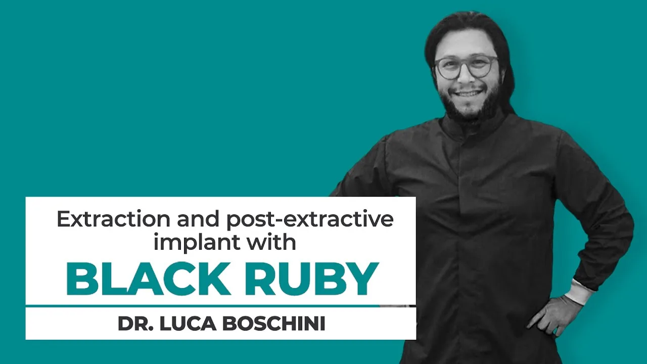 Clinical case — Black Ruby implant site preparation in real practice
